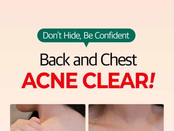 SOME BY MI - AHA, BHA, PHA 30 Days Miracle Acne Clear Body Cleanser