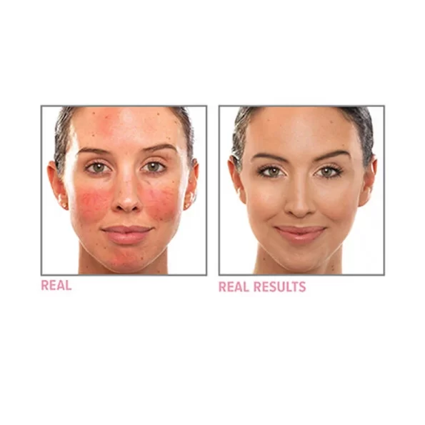 It cosmetics foundation bye bye redness correcting cream before after.webp