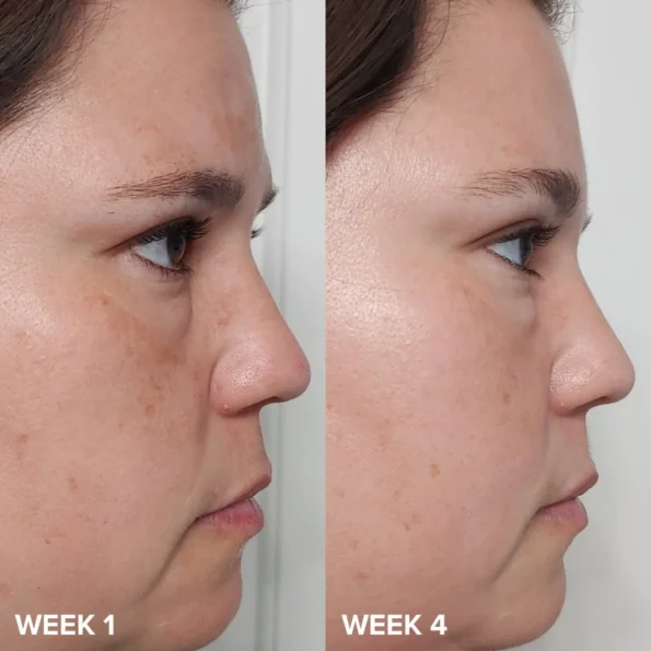 Paula's Choice 2% BHA Liquid Exfoliant 118ML