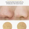 Blackheads 4