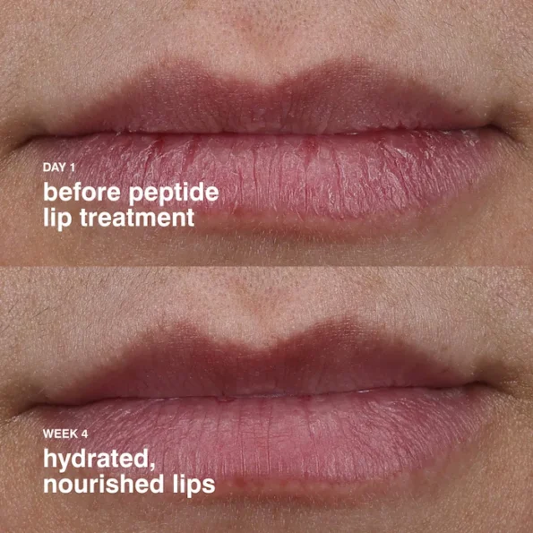 s2895811-av-9202509071212177060700-zoom rhode Peptide Lip Treatment