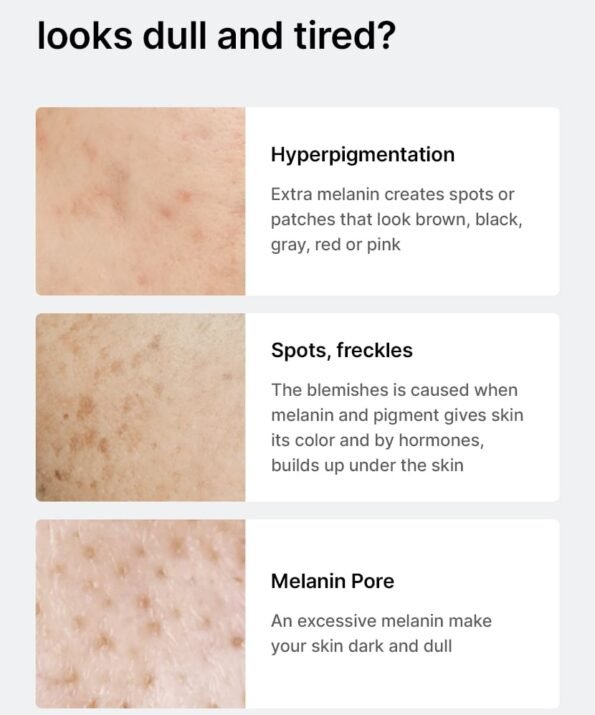 L_g0205163346_004 celimax Pore + Dark Spot Brightening Serum