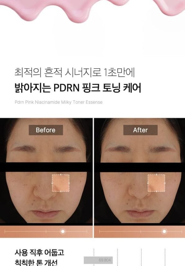 L_g0218112397_006 Medicube PDRN Pink Niacinamide Milky Toner